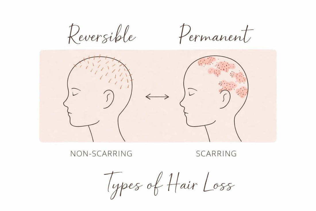 Two Types of Hair Loss: Why Some Hair Loss Is Reversible and Some Is Permanent