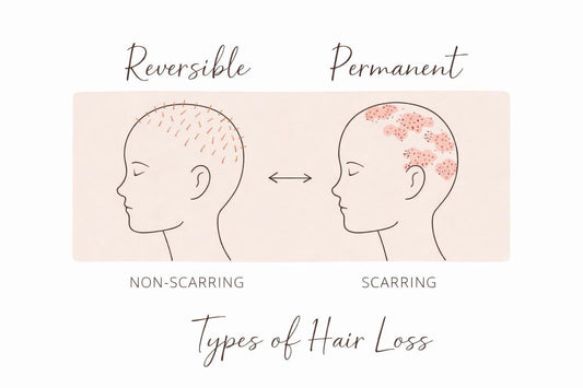 Two Types of Hair Loss: Why Some Hair Loss Is Reversible and Some Is Permanent